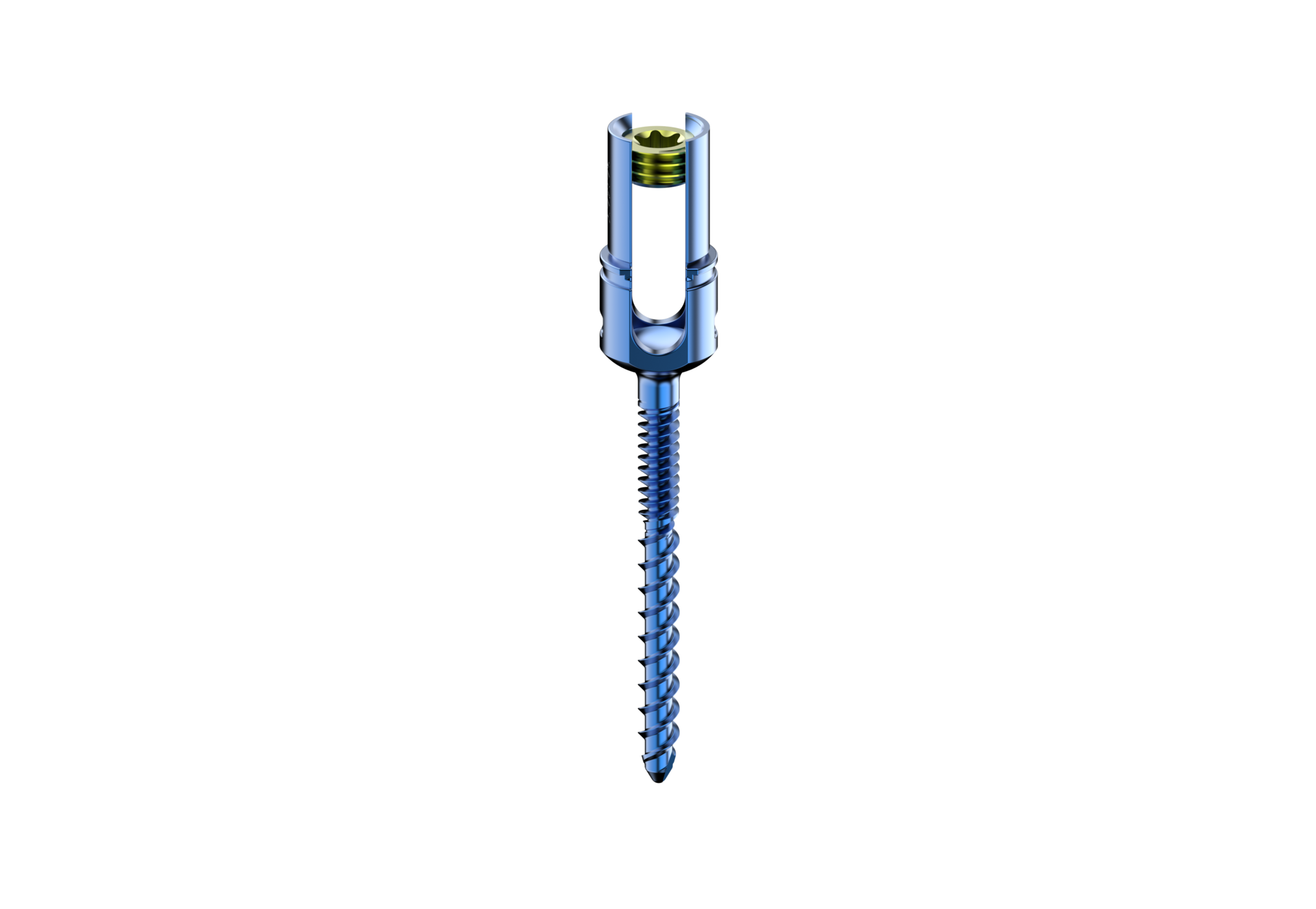 Monoaxial Reduction Dual Thread Screw Spine Screw